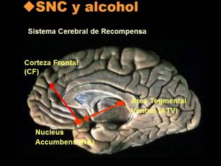 Tanto como donde ser codificado del alcoholismo en odesse el precio